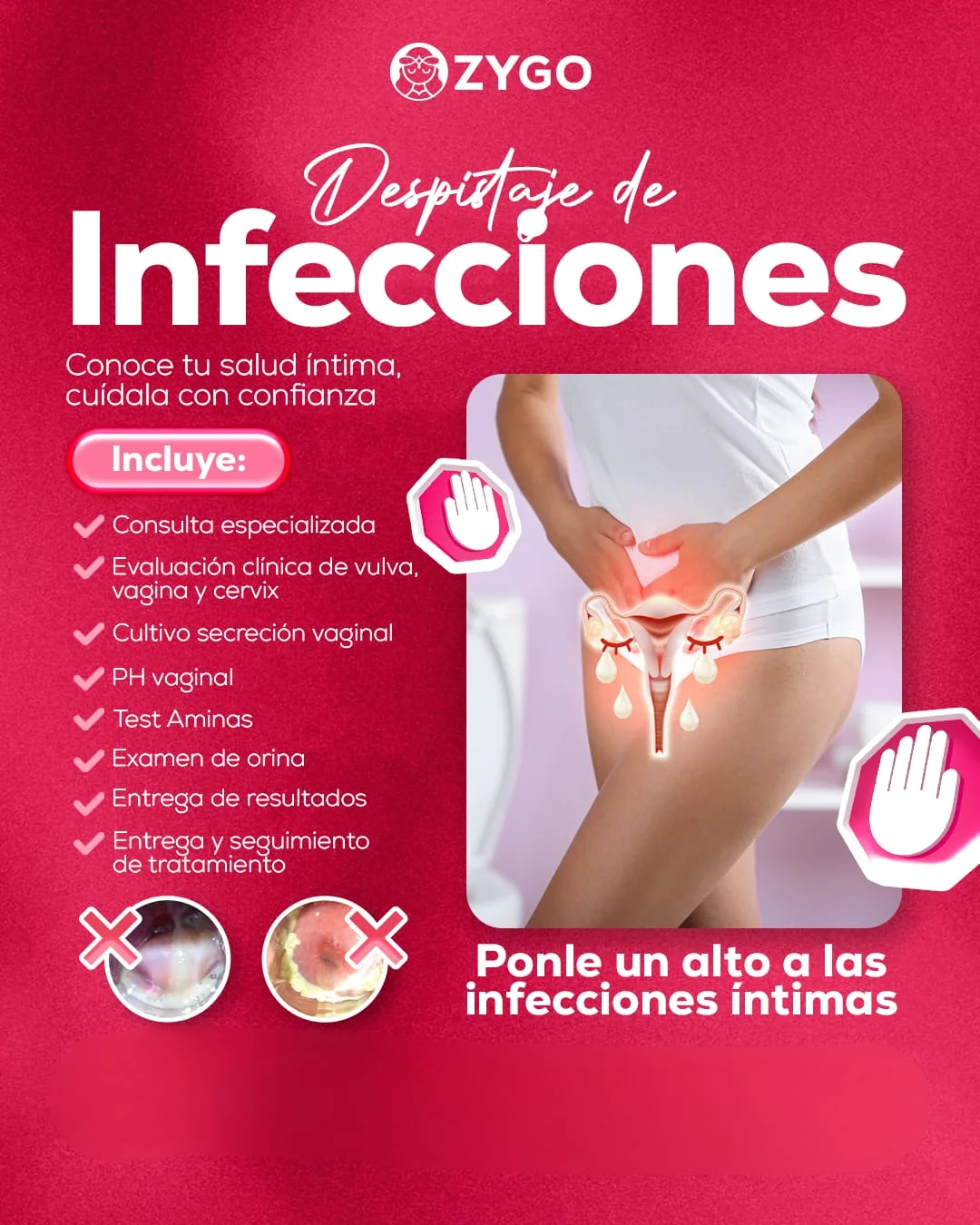 Infecciones Vaginales